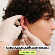 سعر عملية تجميل الأذن اليوم في السعودية